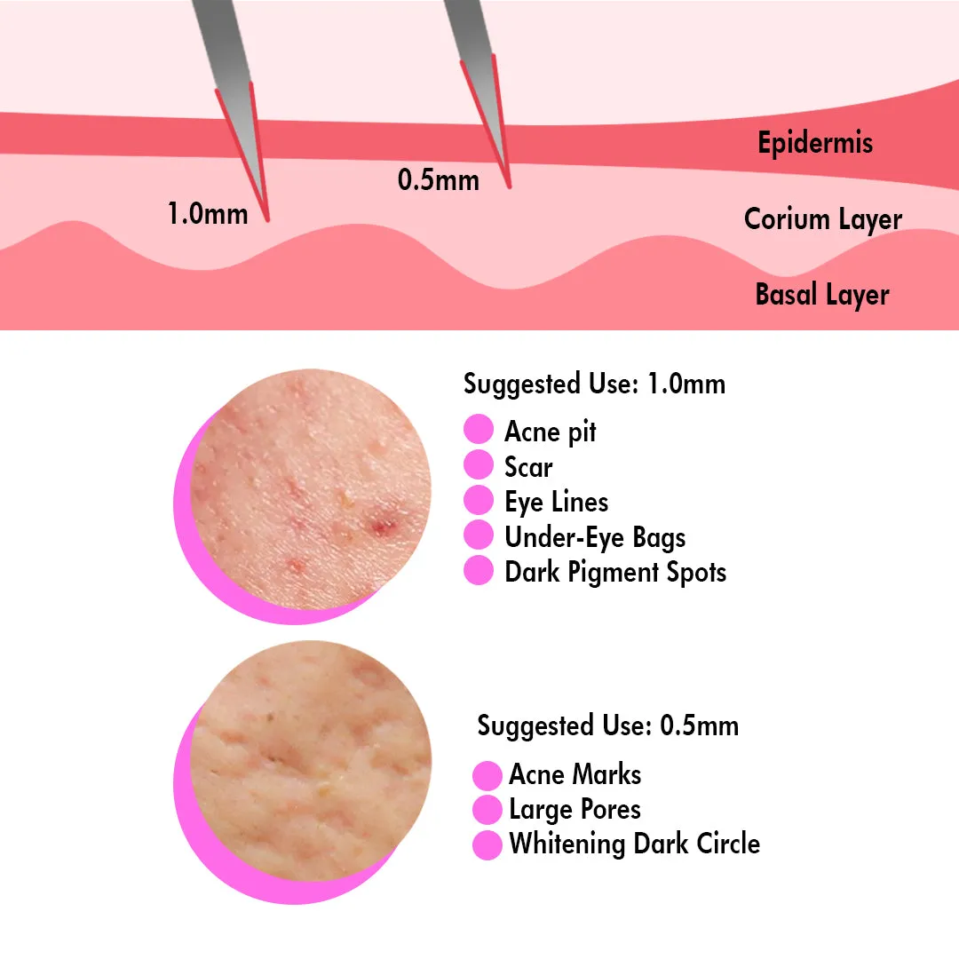 0.75 MM Dermaroller 540 Titanium Micro Needle Roller