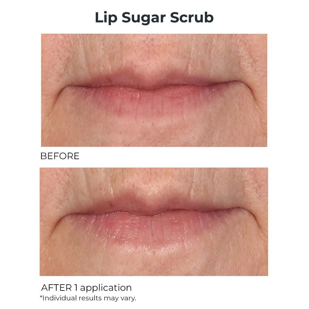 Hydro-Screen Lip Plumper & Lip Sugar Scrub Duo