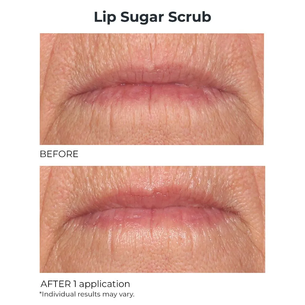 Hydro-Screen Lip Plumper & Lip Sugar Scrub Duo