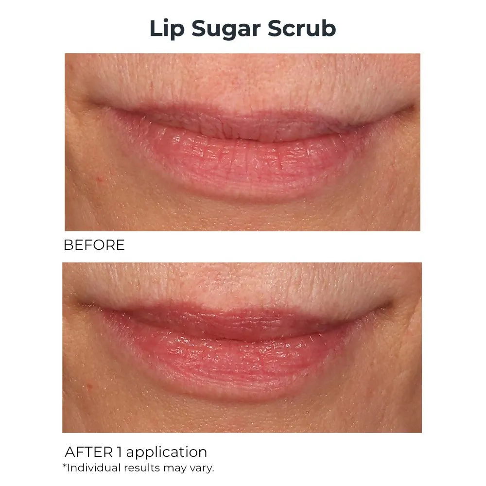 Hydro-Screen Lip Plumper & Lip Sugar Scrub Duo